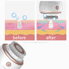 Anti-Acne Brush for Sensitive Skin