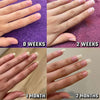 Rapid Nail Repair & Hydration