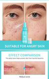 Hypochlorous Acid (HOCl) Skin Spray for Sensitive, Acne-Prone